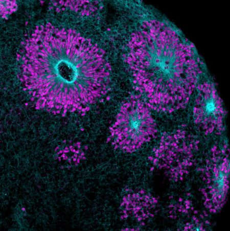 Cortical brain in organoid. Photo supplied.